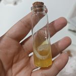حلزون اچانتینا